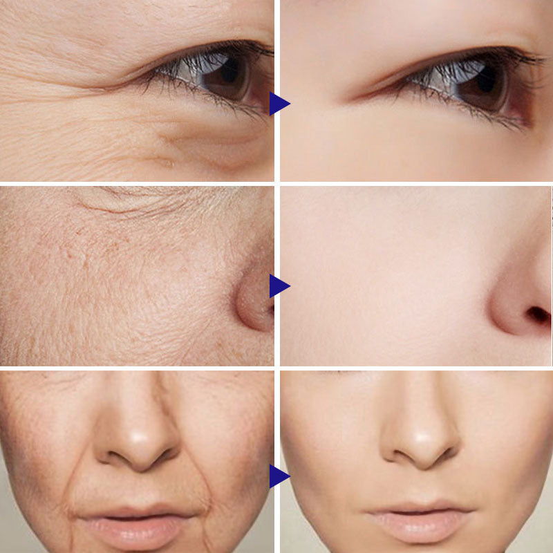 Krispfy Cosmetics Vitamin C Serum Facial Serum